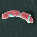 Image of Listeria monocytogenes organism